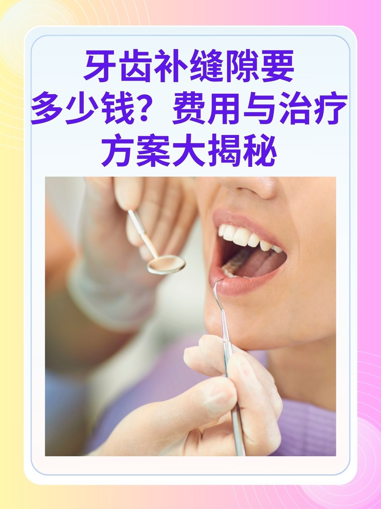 漳州补牙医保可以报销吗(补牙医保可以报销吗 哪些可以报销呢)